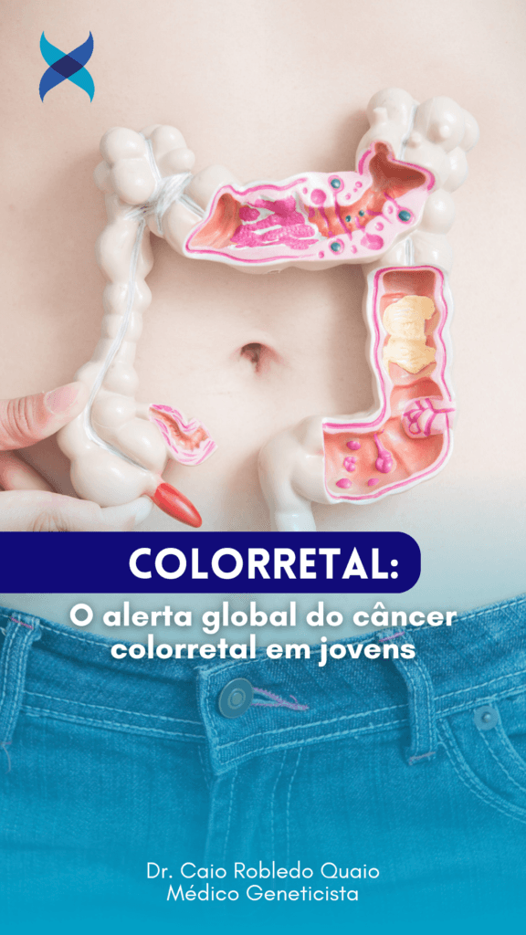 O alerta global do câncer colorretal em jovens