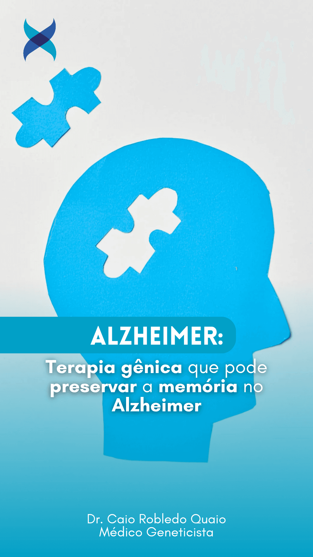 Terapia gênica que pode preservar a memória no Alzheimer Em um avanço promissor na luta contra a doença de Alzheimer, pesquisadores da Universidade da Califórnia desenvolveram uma nova forma de terapia gênica que protege o cérebro mesmo após o surgimento dos sintomas do Alzheimer. Ao invés de focar nos acúmulos tóxicos de proteínas, alvos tradicionais no tratamento da doença, essa abordagem atua diretamente no comportamento das células cerebrais, reprogramando-as para um estado mais saudável. No estudo, os cientistas testaram a terapia em camundongos com Alzheimer em fase sintomática e observaram que a memória dependente do hipocampo foi preservada: uma função cognitiva central e frequentemente prejudicada na doença. Os camundongos tratados apresentaram padrões de expressão genética semelhantes aos de camundongos saudáveis, sugerindo que o tratamento não apenas desacelera a degeneração, mas também pode restaurar circuitos neuronais afetados. O segredo dessa nova terapia está na superexpressão do gene Caveolin-1 (Cav-1) em neurônios, promovida por um vetor viral (AAV9-Synapsin) que direciona a entrega do gene de forma específica ao sistema nervoso. O Cav-1 atua como uma “plataforma de sinalização” nas membranas dos neurônios, ativando caminhos moleculares ligados à sobrevivência e regeneração das células. Nos experimentos, essa estratégia ativou proteínas essenciais para a plasticidade sináptica, como CaMKII e CREB, e restaurou receptores associados à neuroproteção. Embora o estudo ainda esteja em fase pré-clínica, os resultados representam uma nova fronteira na terapia do Alzheimer. Além disso, a mesma tecnologia já recebeu designação de “droga órfã” pela FDA para uso em esclerose lateral amiotrófica (ELA), o que pode acelerar seu caminho até ensaios clínicos em humanos. Link para o estudo: http://dx.doi.org/10.1038/s41392-025-02258-z Conteúdo elaborado por: Dr. Caio Robledo Quaio, MD, MBA, PhD Médico Geneticista - CRM-SP 129.169 / RQE nº 39130 #Alzheimer #TerapiaGênica #Neurociência #Memória #Caveolin1 #Neuroproteção #Demência #Biotecnologia #GeneTherapy #Ciência #EducaçãoMédica #Geneaxis #Genética #Genômica #MedicinaDePrecisão #MedicinaPersonalizada