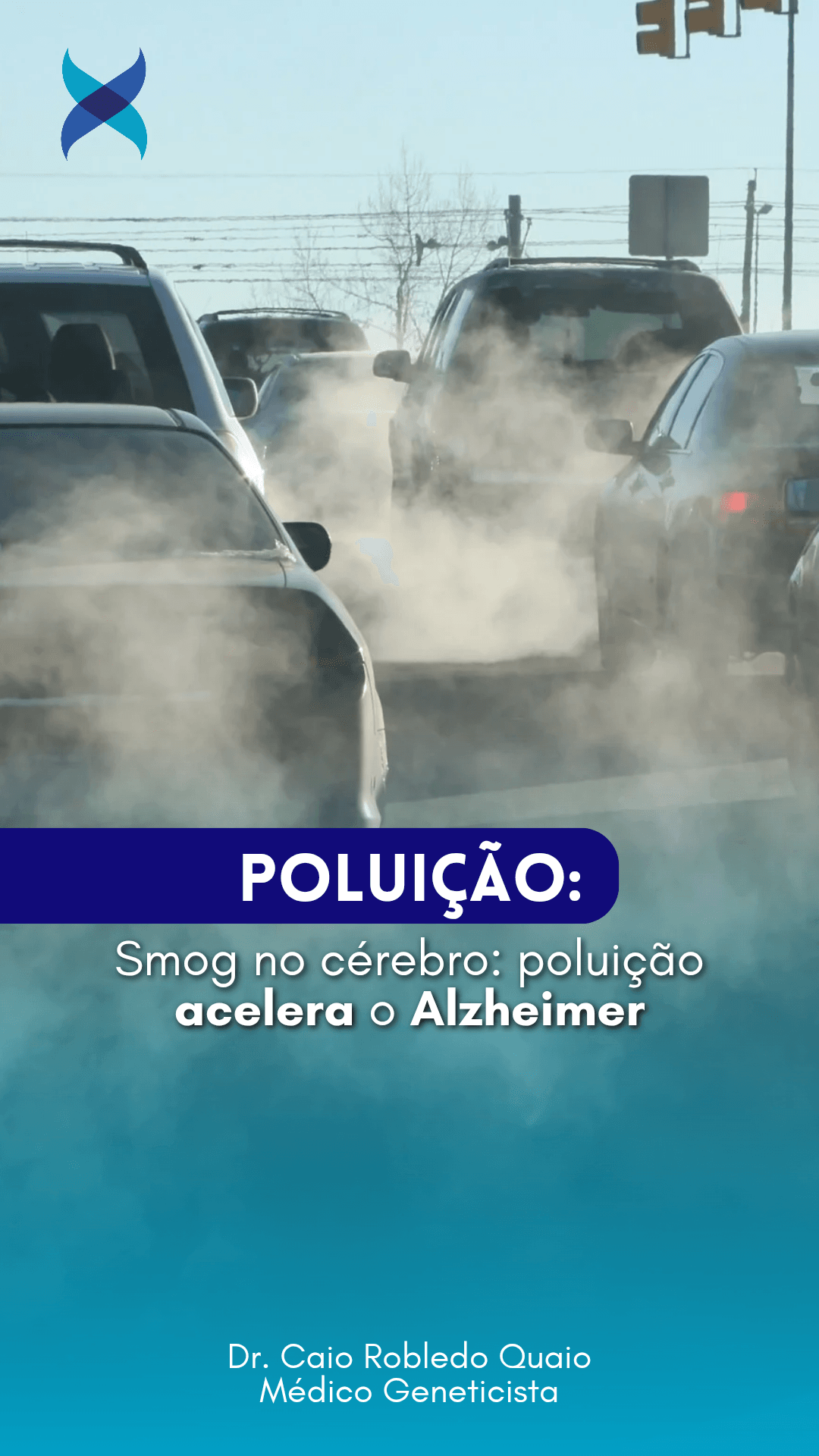 PM2.5 acelera patologia de Alzheimer e declínio cognitivo — evidência neuropatológica