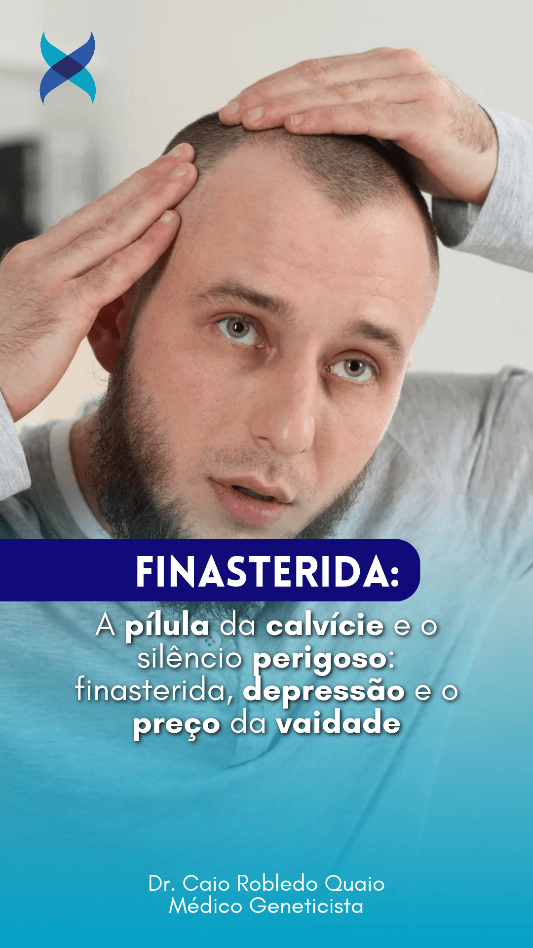 Finasterida e saúde mental — depressão, ansiedade e risco de suicídio (revisão em Journal of Clinical Psychiatry)