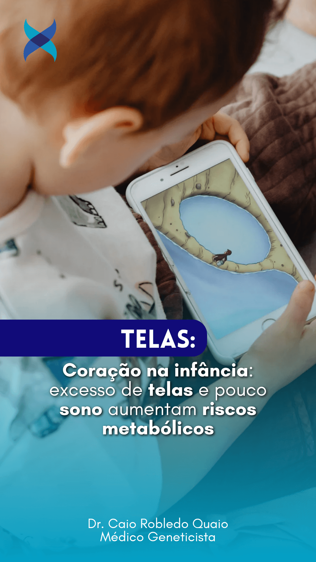 Estudo em crianças e adolescentes mostra que excesso de telas e pouco sono aumentam o risco cardiometabólico infantil. Entenda o impacto na prática clínica.