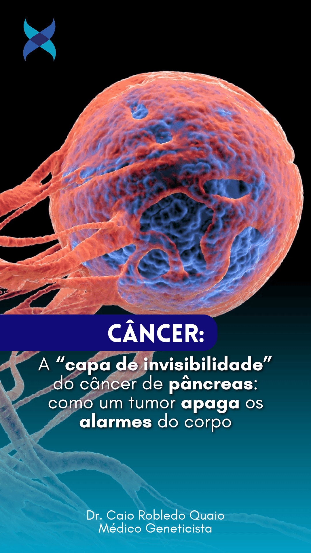 câncer de pâncreas e imunidade – MYC e capa de invisibilidade do tumor.