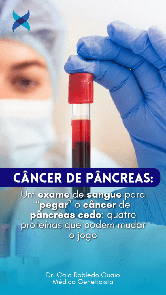 Um exame de sangue para “pegar” o câncer de pâncreas cedo: quatro proteínas que podem mudar o jogo