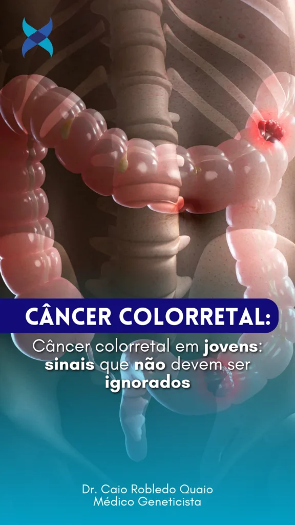 Câncer colorretal em jovens: sinais de alerta que não devem ser ignorados
