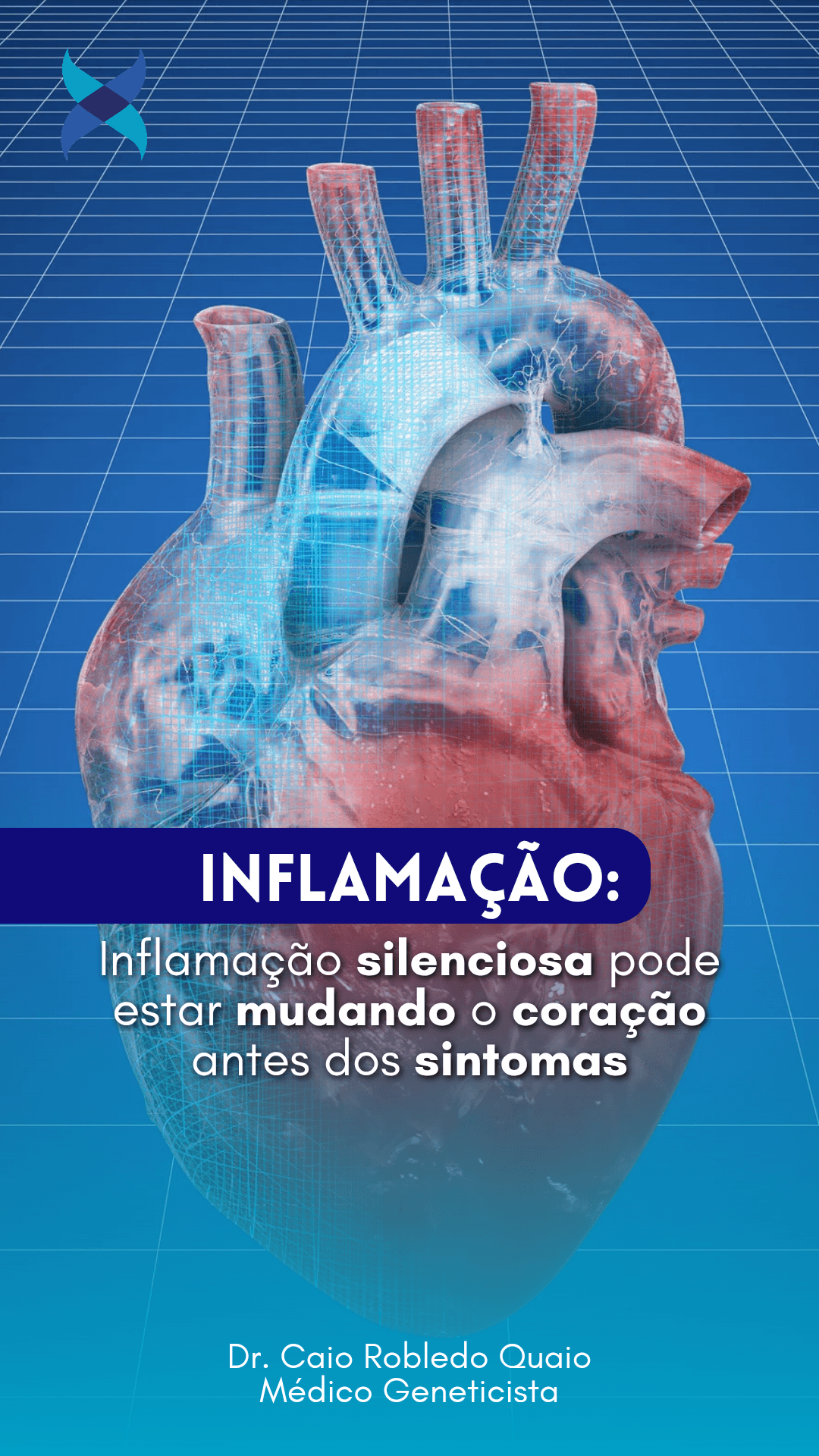 Inflamação crônica e coração: estudo relaciona GlycA a alterações cardíacas e risco cardiovascularInflamação crônica e coração: estudo relaciona GlycA a alterações cardíacas e risco cardiovascular