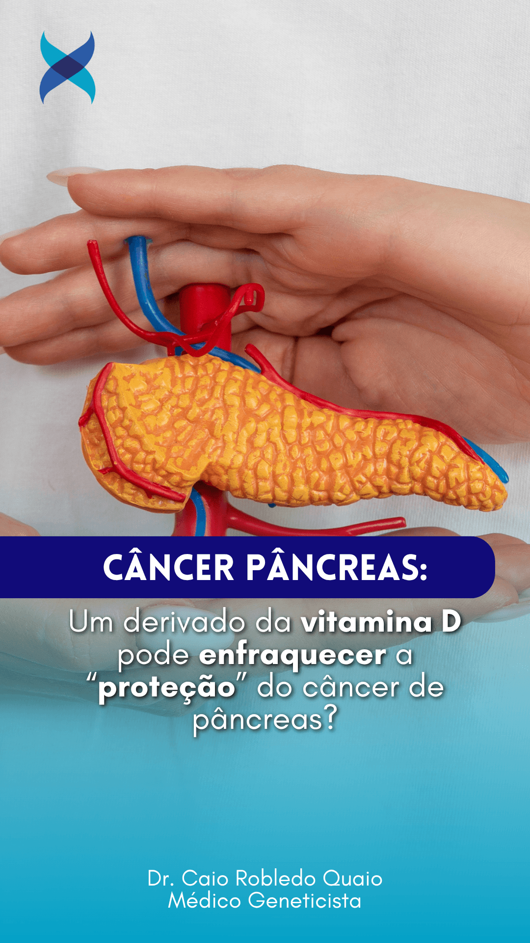 Paricalcitol no câncer de pâncreas e modulação do microambiente tumoral